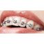 Picture of ORTHODONTIC ADUL TB 2585